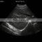 UTouch-10 Touch Screen PC Based BW Ultrasound Scanner
