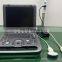 MY-A024F medical machines laptop ultrasound color doppler full digital portable ultrasound for sale