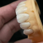 Shenzhen Full service Dental Lab | China Dental Supplier