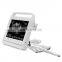 MY-A023G Touch color doppler ultrasound machine Price/portable color ultrasound system