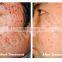 Led Light Therapy Home Devices Top Grade Top Sell Pdt/led Light Phototherapy Machine Ce Facial Led Light Therapy