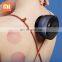 New Xiaomi Portable Left Point Intelligent Cupping Massager Vacuum Suction Cups Magnet Therapy Guasha Scraping Heating Massage