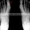 medical dry film agfa mqct-178/14x17in blue dry x ray film with high quality and cheap price/blue x ray medical film