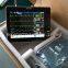 Unbreakable Multi Parameter Patient Monitor 8 Inch Portable