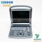 3D 4D portable ultrasound machine Chison color doppler for sale