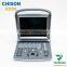 chison eco5 famous brand color doppler hot sale ultrasound