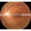 Best Ophthalmic Equipment Price Non-mydriatic digital eye fundus Retinal Camera