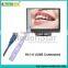 High Resolution Sensor / Output by USB / Dental Intra-Oral Camera HI-I-11