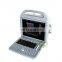 MY-A027 Portable Laptop 3D Color Doppler Portable B Ultrasound Scanner