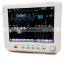 High Quality OEM  Neonates Children Adults Cardiac  Monitor 8 inch vital sign monitor