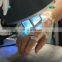 2022 Portable excimer laser system excimer laser 308nm psoriasis vitiligo treatment for vitiligo psoriasis eczema