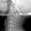 radiographic x ray digital radiography equipment medical x ray equipment digital xray film                        
                                                Quality Choice