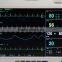 2016 Cheap Hospital and Clinic Use Touch Screen Multi-Parameter Patient Monitor with Printer and ETCO2 Trolley RPM-9000A