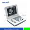 Notebook Type Black and White Ultrasound Scanner