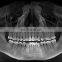 MY-D065A Cheap Price Panoramic CBCT Dental Imaging System Digital Radiography Workstation