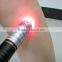 Eliminate edema / 150mw handy soft cold laser