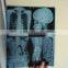 Konida medical laser x-ray film agfa/Dry thermal film