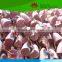 Hot selling Medical teaching human 4-stage liver model
