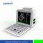 Portable B/W Ultrasound Scanner with Clear Image Quality Medical Equipment