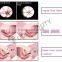 Carboxytherapy Amazing Co2 Laser Vaginal Tightening Fractional Co2 Laser Scar Removal Machine Multifunctional