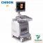 Mobile 4D color doppler ultrasound systme Chison trolley ultrasound