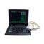 CMS600P Palm-size Medical Ultrasound scanner