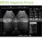 Black and white images digital portable ultrasound machine price Manufacture Supplies- BPU09