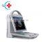 HC-A012A Cheapest Portable Veterinary Pet Ultrasound Machine Full Digital Colour Doppler Ultrasound Scanner for Vet