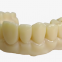 CROWNS & BRIDGES | ALL CERAMICS Zirconia Layered