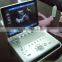 2016 color doppler ultrasound for human with laptop