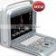2016 Laptop/Portable 3D 4D ultrasound machine color doppler Diagnostic System