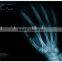 Konida medical dry film 14*17in compatible with Agfa and Fuji