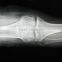 konida high sharpness dt2b/diht/dvb medical x ray films