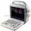 Popular Portable Color Doppler Ultrasound Scanner