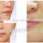 Fractional rf wrinkle removal machine skin white whitening cream