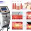 best soprano laser hair removal machine price