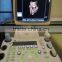 Mobile Color Doppler System 3D 4D S11 Sonoscape Echography