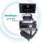 Best price medical ultrasound machine 4D color dopper SonoScape S50