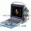 Portable Color Doppler Ultrasound Scanner System