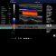 Trolley Color doppler 3D ultrasound machine price/ 3D color doppler ultrasound machine with competitive price
