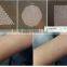 Rf Metal Tube Laser Equipment Spot Scar Pigment Removal Fractional Co2 Laser For Sale Stretch Mark Removal