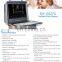MY-A027C medical ultrasonido doppler portatil laptop cheapest portable ultrasound machine with convex probe