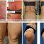 high quality weight loss beauty lipo machine/lipo laser body slimming machine