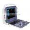 Hot selling 12 inch color ultrasound doppler machine for clinic and home use