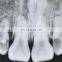 Factory price Digital Dental X-ray Unit in good quality