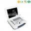 MY-A007B medical portable Full-digital beam imaging technology Laptop Ultrasound Scanner with USB type Probe