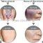 yag laser of tatoo accurate removal