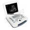DW580 Full-digital Laptop Ultrasound Scanner