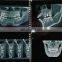MY-D068 medical supplies hospital digital dental panoramic x ray machine with CEPH