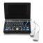 Ultrasound manufacture-2016 China Medical Portable Mini Laptop Notebook ultrasound Machine scanner with CE(PC based) RUS-9000E2